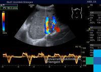 Stauungsleber Sonographieatlas Erlangen