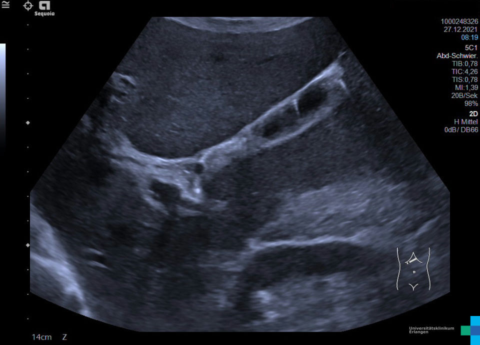 Basic physics of ultrasound imaging